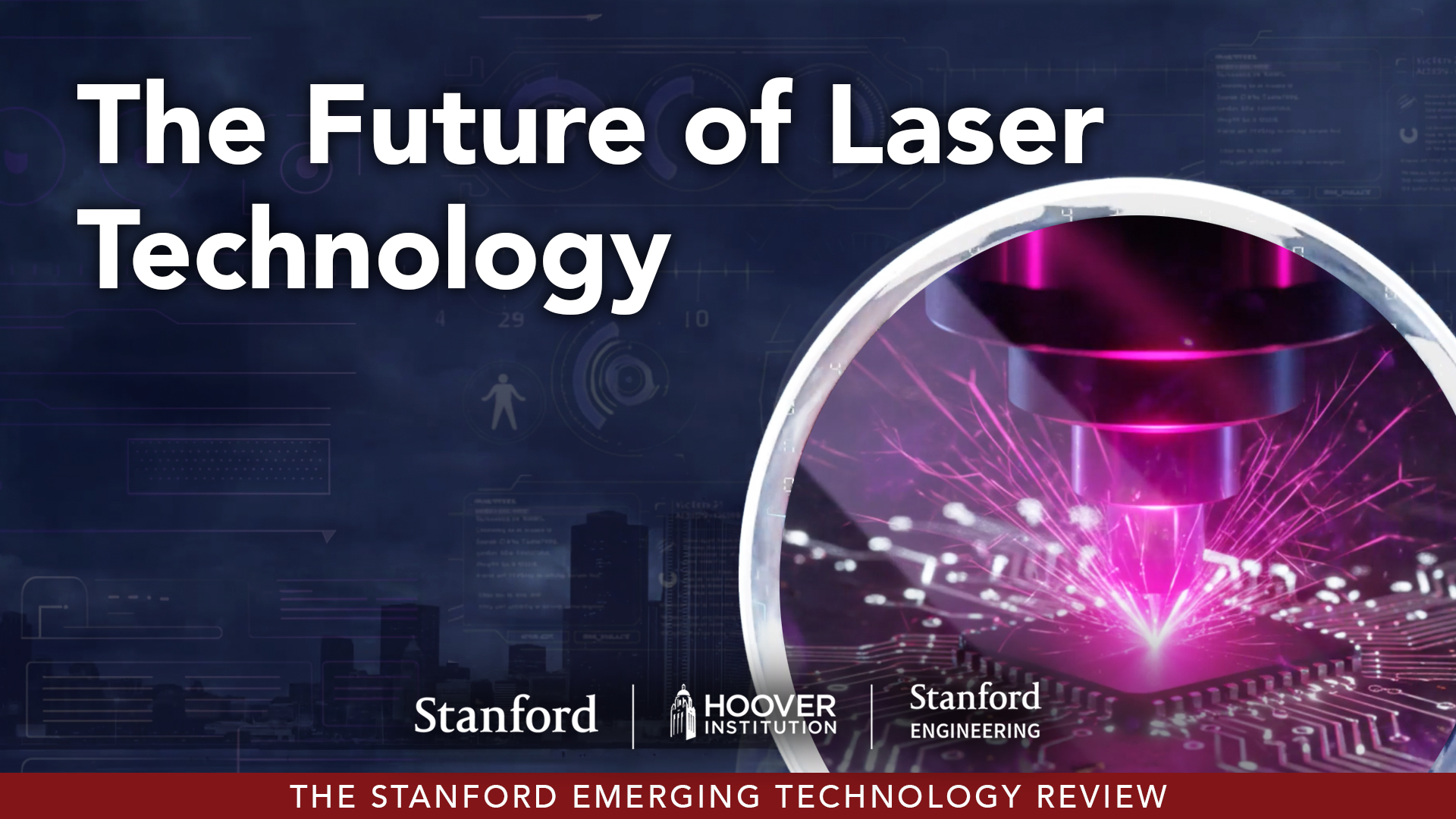 Lasers