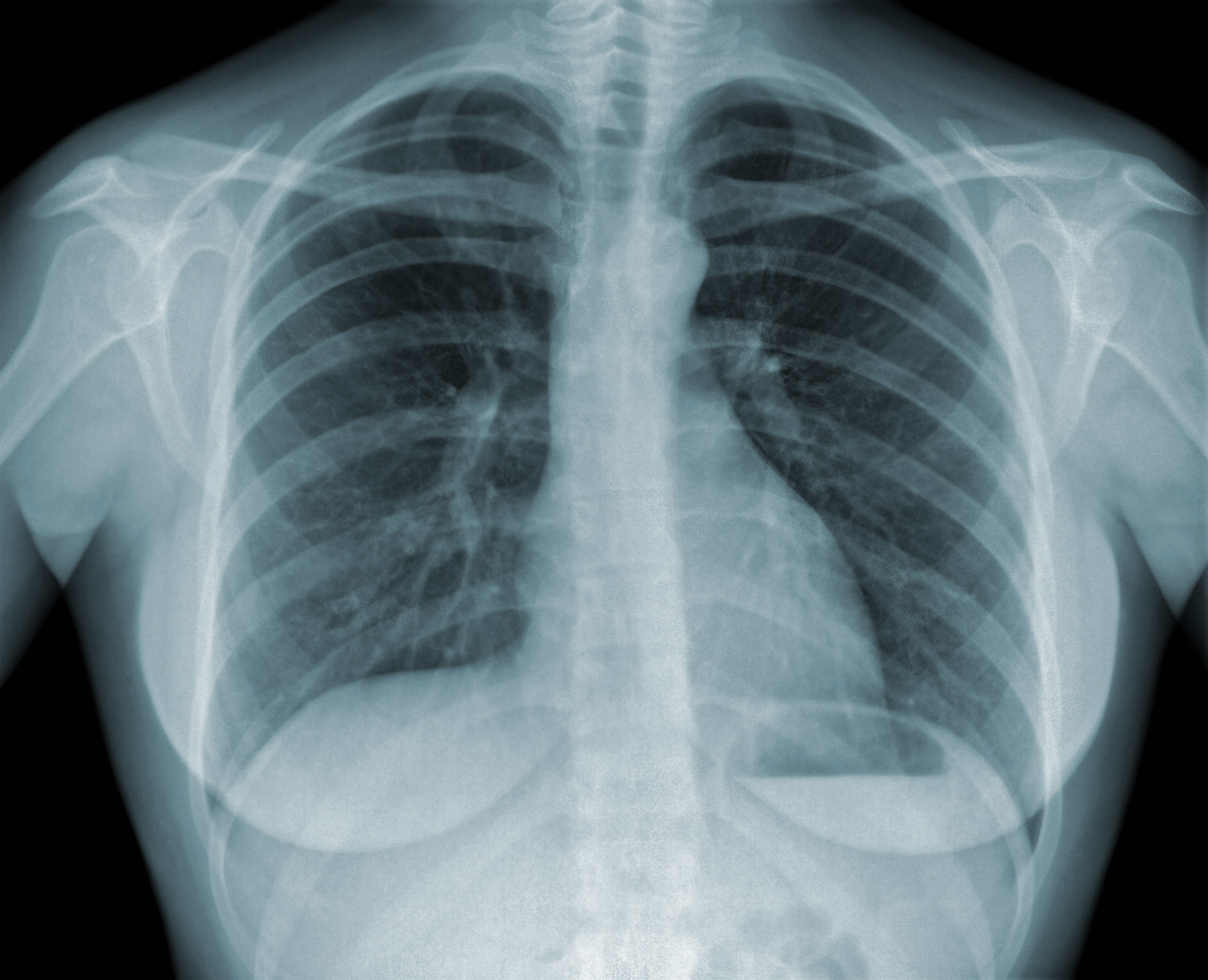 xray_shutterstock_80449837.jpg