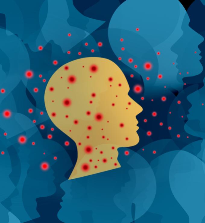 Measles Outbreak stock photo