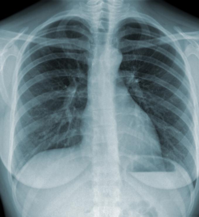 xray_shutterstock_80449837.jpg
