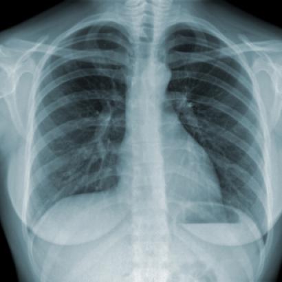 xray_shutterstock_80449837.jpg
