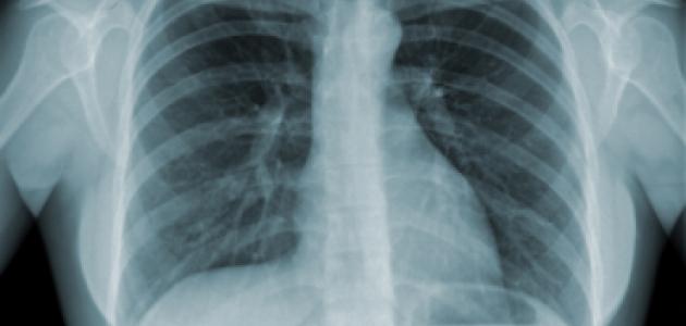 xray_shutterstock_80449837.jpg