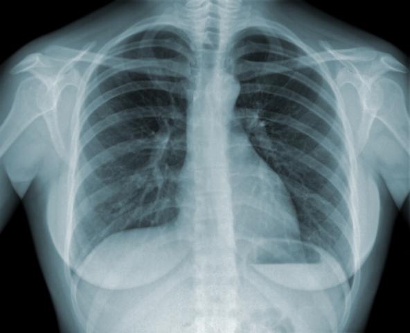 xray_shutterstock_80449837.jpg