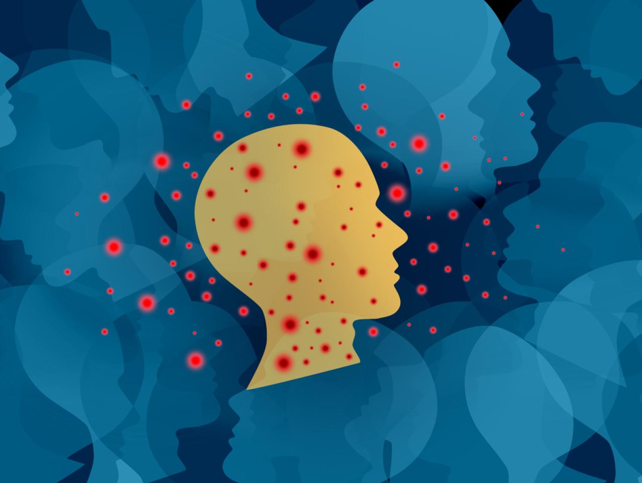 Measles Outbreak stock photo