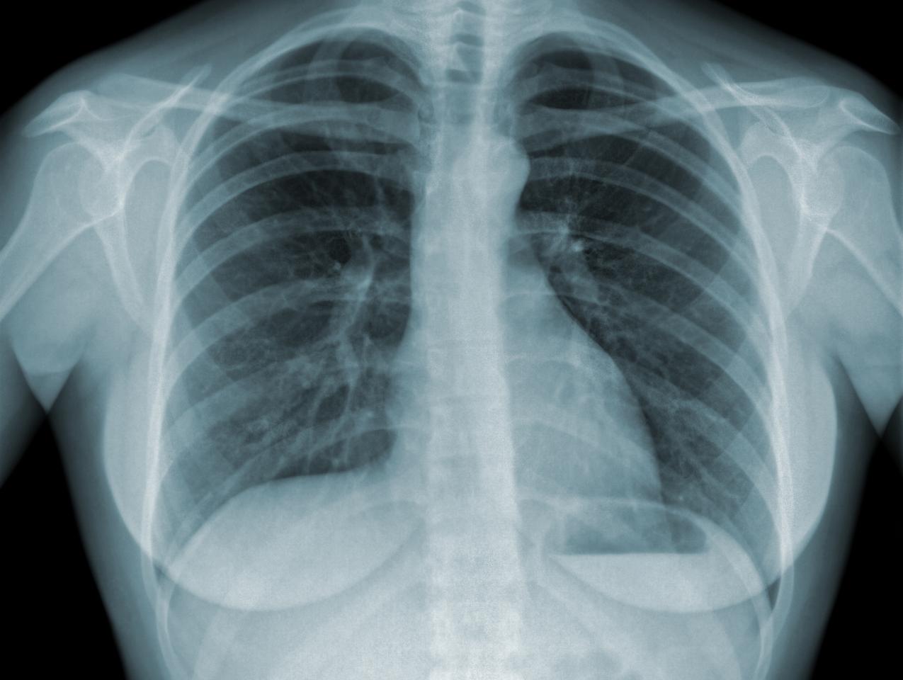 xray_shutterstock_80449837.jpg